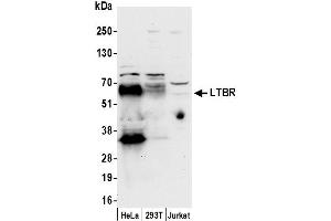 Western Blotting (WB) image for anti-Lymphotoxin beta Receptor (TNFR Superfamily, Member 3) (LTBR) (AA 385-435) antibody (ABIN7449763)