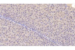Detection of CHEM in Human Liver Tissue using Monoclonal Antibody to Chemerin (CHEM) (Chemerin anticorps  (AA 33-158))