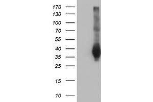 Western Blotting (WB) image for anti-Family with Sequence Similarity 84, Member B (FAM84B) antibody (ABIN1498212) (FAM84B anticorps)
