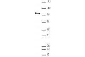 CHD3 antibody (rAb) tested by Western blot. (Recombinant CHD3 anticorps  (AA 865-885))