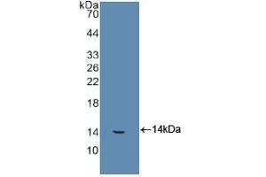 Detection of Recombinant FGb, Human using Polyclonal Antibody to Fibrinogen Beta Chain (FGB)