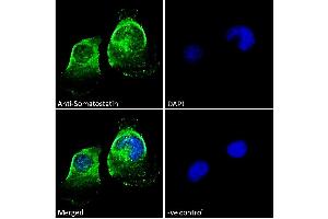 ABIN7013881 Immunofluorescence analysis of paraformaldehyde fixed U251 cells, permeabilized with 0. (Somatostatin anticorps  (AA 58-70))