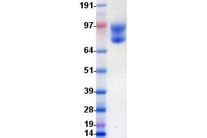 Validation with Western Blot