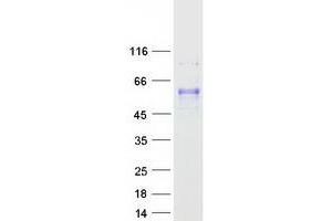 Validation with Western Blot