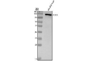 Western blot analysis of Chordin/CHRD using anti-Chordin/CHRD antibody (A).