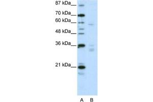 Western Blotting (WB) image for anti-Zinc Finger Protein 440 (ZNF440) antibody (ABIN2461986) (ZNF440 anticorps)