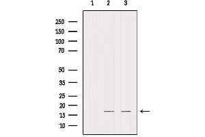 Western blot analysis of extracts from various samples, using IFT20 Antibody.