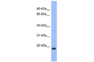 WB Suggested Anti-RHEB Antibody Titration: 0. (RHEB anticorps  (Middle Region))