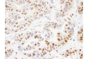 Immunohistochemistry (IHC) image for anti-PHD Finger Protein 8 (PHF8) (AA 650-700) antibody (ABIN7448725) (PHF8 anticorps  (AA 650-700))
