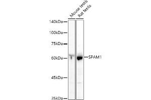 Western blot analysis of extracts of various cell lines, using SP antibody (ABIN3022967, ABIN3022968, ABIN1513554 and ABIN6219322) at 1:1000 dilution.