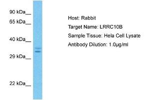 Host: Rabbit Target Name: LRRC10B Sample Type: Hela Whole Cell lysates Antibody Dilution: 1. (LRRC10B anticorps  (C-Term))