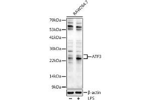 Western blot analysis of extracts of R. (ATF3 anticorps  (AA 1-181))