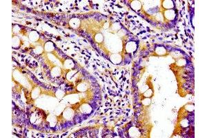 Immunohistochemistry of paraffin-embedded human small intestine tissue using ABIN7157571 at dilution of 1:100