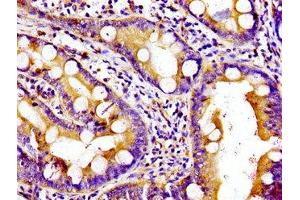 Immunohistochemistry of paraffin-embedded human small intestine tissue using ABIN7157571 at dilution of 1:100 (KIF5B anticorps  (AA 338-514))