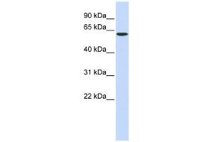 SPTLC1 antibody used at 1 ug/ml to detect target protein. (SPTLC1 anticorps  (Middle Region))