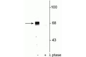 Western blot of rat hippocampal lysate showing specific immunolabeling of the ~68 kDa to ~70 kDa PAK protein phosphorylated at Ser402 in the first lane (-). (PAK1-3 (pThr402) anticorps)