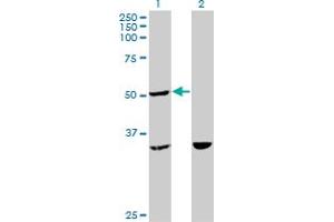 Western Blot analysis of TTC4 expression in transfected 293T cell line by TTC4 monoclonal antibody (M09), clone 1E10. (TTC4 anticorps  (AA 1-100))