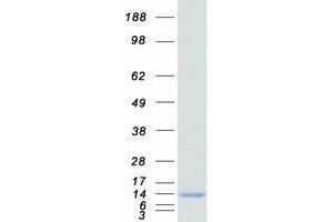 Validation with Western Blot