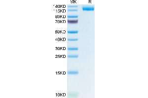 Human LIF R/CD118 on Tris-Bis PAGE under reduced condition.