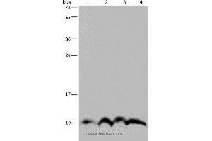 Western blot analysis of SKOV3 cell and human fetal liver tissue, human fetal brain tissue and Hela cell, using NDUFA4 Polyclonal Antibody at dilution of 1:300 (NDUFA4 anticorps)