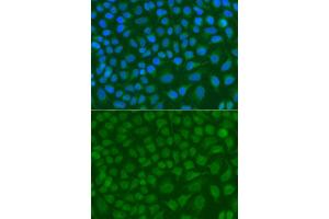 Immunofluorescence analysis of A549 cell using SSX5 antibody. (SSX5 anticorps)