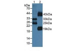Western blot analysis of (1) Mouse Lung Tissue and (2) Mouse Testis Tissue. (FLT3LG anticorps  (AA 27-189))