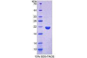SDS-PAGE analysis of Rat PTPN13 Protein. (PTPN13 Protéine)