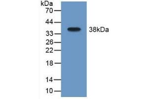 Detection of Recombinant MAOB, Mouse using Polyclonal Antibody to Monoamine Oxidase B (MAOB)