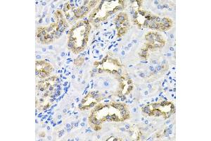 Immunohistochemistry of paraffin-embedded rat kidney using CDCA8 antibody (ABIN6290179) at dilution of 1:100 (40x lens). (CDCA8 anticorps)