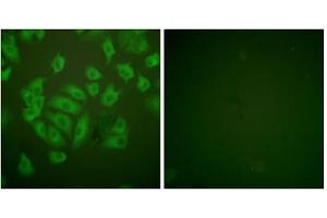 Immunofluorescence analysis of A549 cells, using Stefin A antibody. (CSTA anticorps  (Internal Region))
