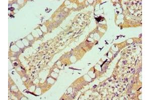Immunohistochemistry of paraffin-embedded human small intestine tissue using ABIN7175561 at dilution of 1:100 (Vitronectin anticorps  (AA 364-478))