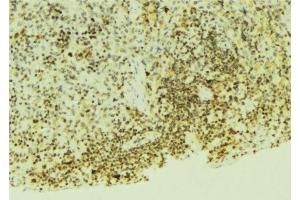 ABIN6276554 at 1/100 staining Mouse pancreas tissue by IHC-P. (EGLN1 anticorps  (Internal Region))