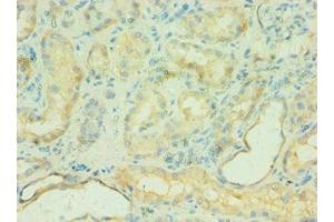Immunohistochemistry of paraffin-embedded human kidney tissue using ABIN7146168 at dilution of 1:100