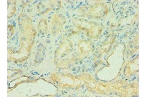 Immunohistochemistry of paraffin-embedded human kidney tissue using ABIN7146168 at dilution of 1:100 (C4BPB anticorps  (AA 18-252))