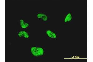 Immunofluorescence of monoclonal antibody to CGGBP1 on HeLa cell. (CGGBP1 anticorps  (AA 58-167))