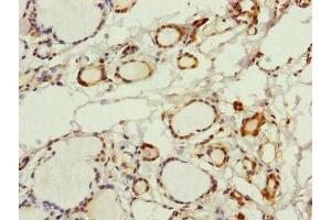Immunohistochemistry of paraffin-embedded human thyroid tissue using ABIN7142705 at dilution of 1:100 (PGLS anticorps  (AA 1-258))
