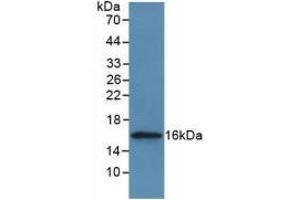 Detection of Recombinant CSTA, Human using Polyclonal Antibody to Cystatin A (CSTA) (CSTA anticorps  (AA 1-98))