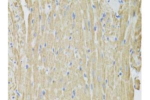 Immunohistochemistry of paraffin-embedded rat heart using FHIT antibody.
