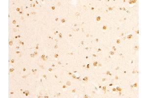 ABIN6267070 at 1/100 staining human brain tissue sections by IHC-P.