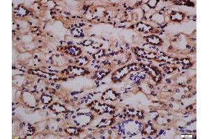 Formalin-fixed and paraffin embedded human kidney labeled with Anti-Nephrin (Tyr1217) Polyclonal Antibody, Unconjugated  at 1:300 followed by conjugation to the secondary antibody and DAB staining.
