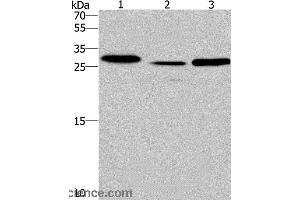 Western blot analysis of Human fetal liver tissue and mouse heart tissue,human testis tissue, using IRAK1BP1 Polyclonal Antibody at dilution of 1:475