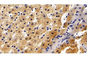Detection of CRP in Porcine Liver Tissue using Polyclonal Antibody to C Reactive Protein (CRP) (CRP anticorps  (AA 20-222))