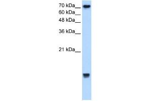 UBE2N antibody used at 2.