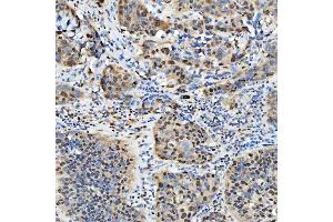 IHC analysis of SNRPD2 using anti-SNRPD2 antibody (ABIN7598963). (SNRPD2 anticorps  (AA 1-118))