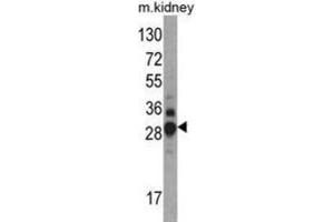 Western Blotting (WB) image for anti-Dimethylarginine Dimethylaminohydrolase 1 (DDAH1) antibody (ABIN3001702) (DDAH1 anticorps)