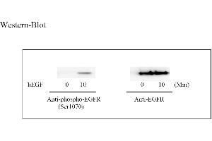 Image no. 3 for Epidermal Growth Factor Receptor (EGFR) ELISA Kit (ABIN625234) (EGFR Kit ELISA)
