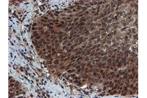 Image no. 11 for anti-Proteasome Subunit alpha 6 (PSMA6) antibody (ABIN1500463)