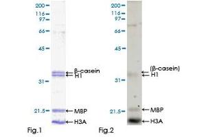 Kinase Activity Assay (KAA) image for Calcium/calmodulin-Dependent Protein Kinase IG (CAMK1G) (AA 1-476) protein (GST tag) (ABIN1347921)