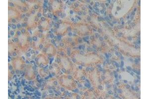 DAB staining on IHC-P; Samples: Rat Kidney Tissue (DGKG anticorps  (AA 287-524))