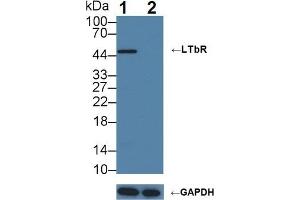 anti-Lymphotoxin beta Receptor (TNFR Superfamily, Member 3) (LTBR) (AA 66-215) antibody